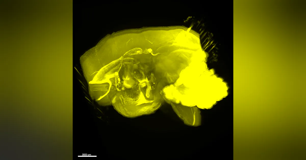 NEUROIMAGING/HIGH-RESOLUTION MICROSCOPY: 'Transparentizing' method ...