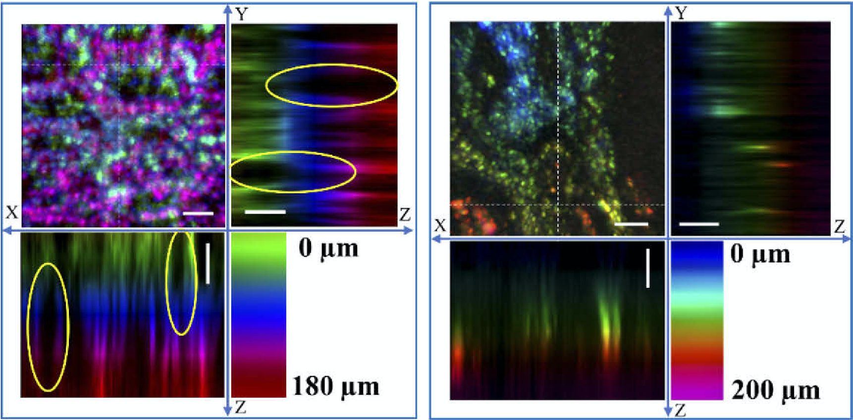 A new chromatic confocal microscope images stomach tissue to a depth of about 200 &micro;m with no mechanical depth scanning. The images of excised normal (left) and cancerous (right) human stomach tissue show clear differences, motivating continued development to make the probe suitable for endomicroscopy.