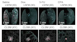 Quantitative evaluation of therapeutic effects of anti-tumor drugs in an experimental lung metastatic model: In vivo therapeutic efficacy of anti-tumor drugs. The 3D images of the lung samples are shown (4T1: mCherry, nuclei: RedDot2).
