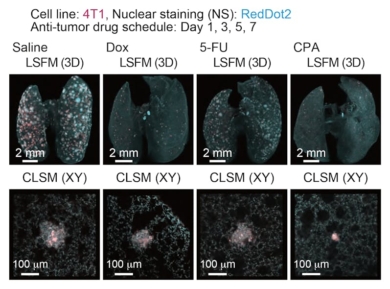 Quantitative evaluation of therapeutic effects of anti-tumor drugs in an experimental lung metastatic model: In vivo therapeutic efficacy of anti-tumor drugs. The 3D images of the lung samples are shown (4T1: mCherry, nuclei: RedDot2).