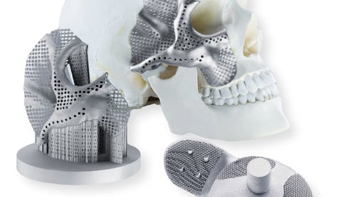 FIGURE 1. Titanium additively manufactured components are very suitable for biomedical applications, such as facial (a) and titanium hip socket (b) implants.