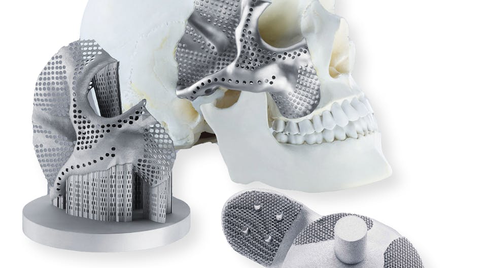 FIGURE 1. Titanium additively manufactured components are very suitable for biomedical applications, such as facial (a) and titanium hip socket (b) implants.