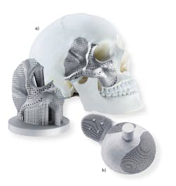 FIGURE 1. Titanium additively manufactured components are very suitable for biomedical applications, such as facial (a) and titanium hip socket (b) implants. FIGURE 1. Titanium additively manufactured components are very suitable for biomedical applications, such as facial (a) and titanium hip socket (b) implants.