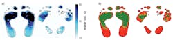 FIGURE 2. (a) Terahertz imaging of foot sole hydration in (left) a diabetic patient without complications and (right) a diabetic patient with a noticeable ulcer on the right metatarsal area. (b) Red pixels indicate hydration levels below 51.7% in the same two patients, which indicate lower deterioration risk (left) and higher ulceration risk (right). FIGURE 2. (a) Terahertz imaging of foot sole hydration in (left) a diabetic patient without complications and (right) a diabetic patient with a noticeable ulcer on the right metatarsal area. (b) Red pixels indicate hydration levels below 51.7% in the same two patients, which indicate lower deterioration risk (left) and higher ulceration risk (right).