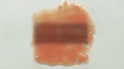 A tissue sample before treatment.