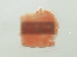 A tissue sample before treatment. A tissue sample before treatment.