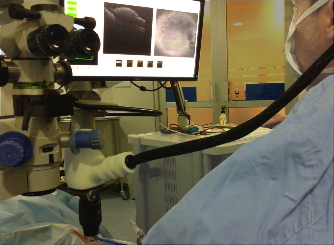 Indications for clinical use of Bioptigen's Envisu system include the evaluation of ophthalmic tissue in routine clinical examinations and as an aid in the diagnosis of conditions that affect the optical scattering properties of ocular tissue.