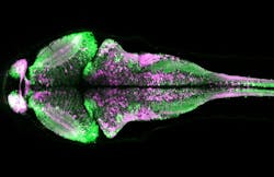 CaMPARI fluorescence in a larval zebrafish brain showing active neurons (magenta) that were marked while the fish was swimming freely. CaMPARI fluorescence in a larval zebrafish brain showing active neurons (magenta) that were marked while the fish was swimming freely.