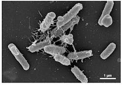 FIGURE 2. E. coli bacteria with nanofibers (pili) adhering to an unmodified PET surface. FIGURE 2. E. coli bacteria with nanofibers (pili) adhering to an unmodified PET surface.