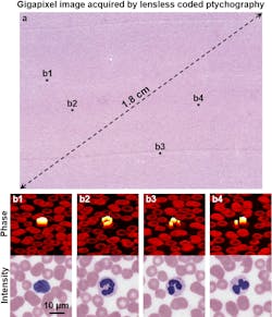 FIGURE 3. The recovered gigapixel image of a blood smear (a) and the zoomed-in views of the recovered phase and intensity (b) are shown. FIGURE 3. The recovered gigapixel image of a blood smear (a) and the zoomed-in views of the recovered phase and intensity (b) are shown.