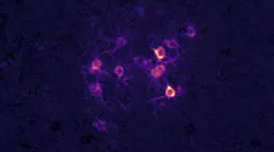 Photostimulation of a targeted group of neurons expressing photoactivatable ion channel ChRmine in the adult auditory cortex.