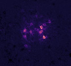 Photostimulation of a targeted group of neurons expressing photoactivatable ion channel ChRmine in the adult auditory cortex. Photostimulation of a targeted group of neurons expressing photoactivatable ion channel ChRmine in the adult auditory cortex.