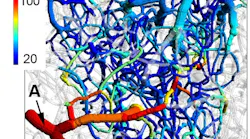 FIGURE 1. Oxygen levels in cerebral microvasculature mapped with 2PLM.