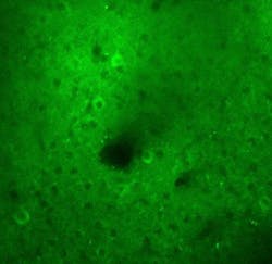FIGURE 2. Mouse cerebral neurons genetically modified to express a green fluorescent sensor for acetylcholine. The black shadow in the middle is a cerebral arteriole traversing the image plane. FIGURE 2. Mouse cerebral neurons genetically modified to express a green fluorescent sensor for acetylcholine. The black shadow in the middle is a cerebral arteriole traversing the image plane.