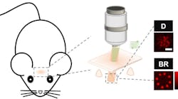Schematic diagram of the all-optical physiology system. Green: the beam for two-photon calcium imaging. Red: the beam for two-photon optogenetics. Diagram at right: excitation pattern distributions tested with 1-micron fluorescent beads. D: disk pattern. BR: beaded ring pattern. Scale bar: 5 microns. Schematic diagram of the all-optical physiology system. Green: the beam for two-photon calcium imaging. Red: the beam for two-photon optogenetics. Diagram at right: excitation pattern distributions tested with 1-micron fluorescent beads. D: disk pattern. BR: beaded ring pattern. Scale bar: 5 microns.