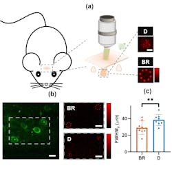 All-optical physiology test with different stimulation patterns on multiple neurons in vivo. a) Schematic diagram of the all-optical physiology system. Green: the beam for two-photon calcium imaging. Red: the beam for two-photon optogenetics. Diagram at right: excitation pattern distributions tested with 1-micron fluorescent beads. D: disk pattern. BR: beaded ring pattern. Scale bar: 5 &micro;m. b) Left: a typical two-photon image of neurons in L2/3 of mouse S1 cortex. Locations of gray spots are the center of two excitation patterns. Right: the intensity distribution of excitation patterns to stimulate target neurons. Scale bar: 10 &micro;m. c) mean axial resolutions of calcium signals of multiple neurons under different simulation schemes. **p=0.0086, ratio paired t test. Compared with disk patterns, the average axial resolution of neurons in a group stimulated by beaded-ring patterns is increased by 24.27%.