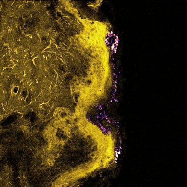 A confocal/multiphoton overlay of excised human skin shows skin autofluorescence excited by 405 nm (yellow) and ZnO nanoparticle distribution in skin (stratum corneum) excited by 770 nm (purple), with collagen-induced faint SHG signals in the dermal layer.