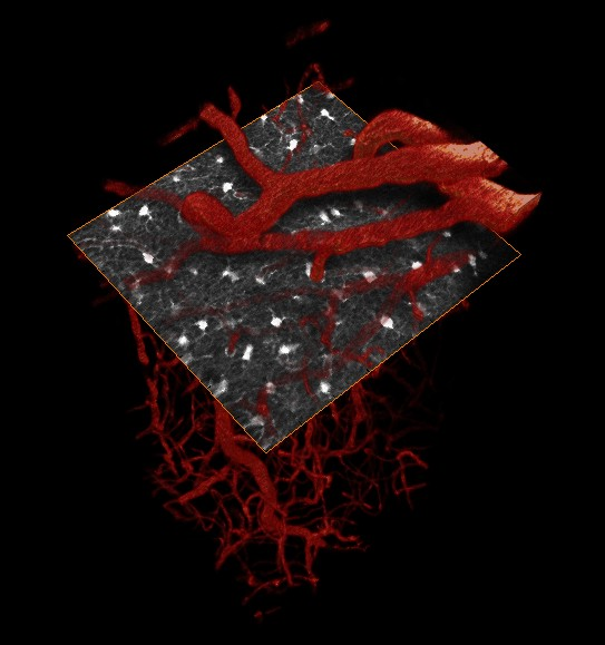 In vivo, 3D two-photon microscopy of mouse somatosensory cortex showing astrocyte (star-shaped glial cells) locations and interactions with vessels in a selected plane. Field of view: 250 &times; 250 &times; 500 &mu;m volume.