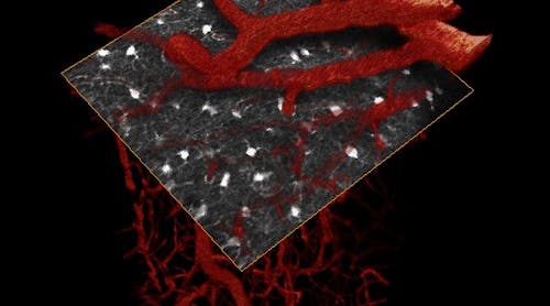 In vivo, 3D two-photon microscopy of mouse somatosensory cortex showing astrocyte (star-shaped glial cells) locations and interactions with vessels in a selected plane. Field of view: 250 &times; 250 &times; 500 &mu;m volume.