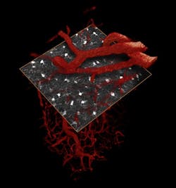 In vivo, 3D two-photon microscopy of mouse somatosensory cortex showing astrocyte (star-shaped glial cells) locations and interactions with vessels in a selected plane. Field of view: 250 × 250 × 500 μm volume. In vivo, 3D two-photon microscopy of mouse somatosensory cortex showing astrocyte (star-shaped glial cells) locations and interactions with vessels in a selected plane. Field of view: 250 × 250 × 500 μm volume.