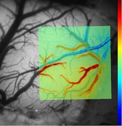 Multispectral exposed cortex optical imaging permits direct observation of increases in blood flow to the active region, and corresponding changes in hemoglobin oxygenation during functional activation. This image of an exposed rodent brain was taken with 530 nm illumination. The overlay shows change in HbO concentration following 4 s of hind-paw stimulation. Multispectral exposed cortex optical imaging permits direct observation of increases in blood flow to the active region, and corresponding changes in hemoglobin oxygenation during functional activation. This image of an exposed rodent brain was taken with 530 nm illumination. The overlay shows change in HbO concentration following 4 s of hind-paw stimulation.