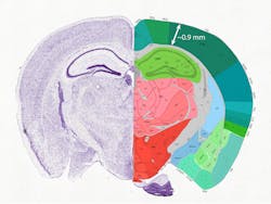 FIGURE 3. The effective depth limit for two-photon imaging of the live mouse brain is around 1 mm, thus restricting this method to studies of the cortex. FIGURE 3. The effective depth limit for two-photon imaging of the live mouse brain is around 1 mm, thus restricting this method to studies of the cortex.