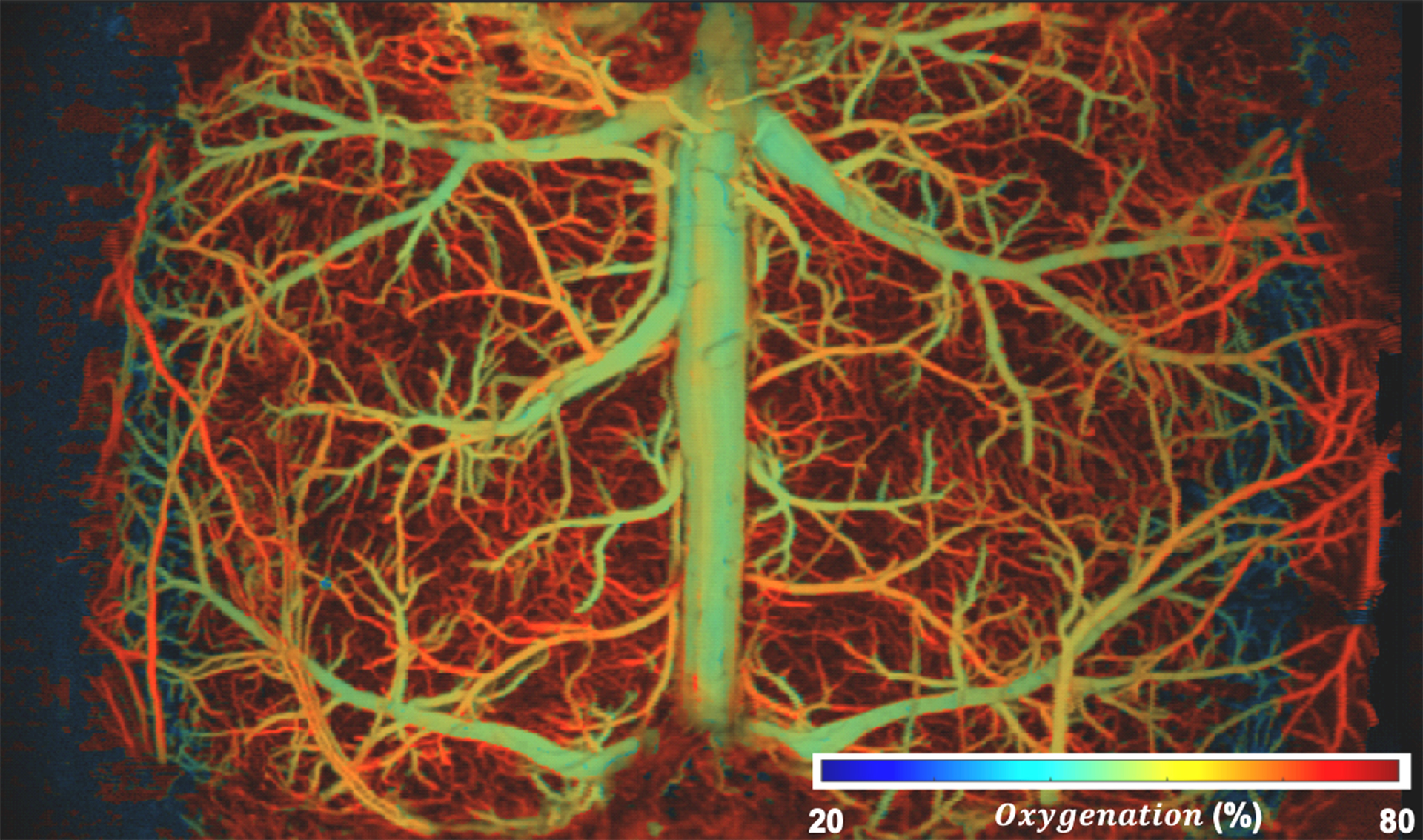 FIGURE 1. Duke University researchers are using a new ultrafast photoacoustic microscopy system to image areas including the vasculature of the brain in unprecedented detail, accuracy, and imaging speed. The colors here illuminate how capillaries experience varying levels of oxygenation as the brain undergoes hypoxia.