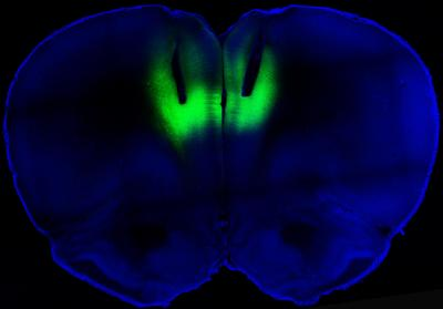 Laser light delivered through fiber-optic cables directed at the prefrontal cortex (shown here by their tracks) is used to modulate firing activity of neurons expressing light-sensitive molecules (shown in green fluorescence) to regulate cocaine-seeking behavior in rats.