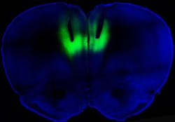 Laser light delivered through fiber-optic cables directed at the prefrontal cortex (shown here by their tracks) is used to modulate firing activity of neurons expressing light-sensitive molecules (shown in green fluorescence) to regulate cocaine-seeking behavior in rats. Laser light delivered through fiber-optic cables directed at the prefrontal cortex (shown here by their tracks) is used to modulate firing activity of neurons expressing light-sensitive molecules (shown in green fluorescence) to regulate cocaine-seeking behavior in rats.
