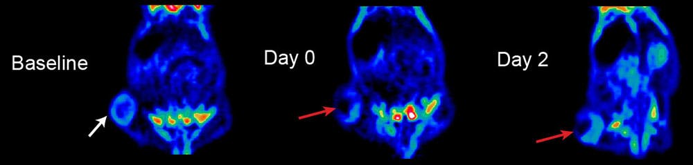 PET scans of a mouse with a large tumor (by the white arrow). The tumor is treated with nanoparticles, which are injected directly into the tumor and are then flashed with near-infrared laser light. The laser light heats the nanoparticles, thus damaging or killing the cancer cells (red arrows).
