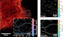 FIGURE 2. MIET-SMLM imaging of microtubules and clathrin pits in COS7 cells. Spectral splitting (inset) allows researchers to efficiently distinguish between two different targets. MIET imaging (right panel) gives height profiles with exceptionally high resolution. FIGURE 2. MIET-SMLM imaging of microtubules and clathrin pits in COS7 cells. Spectral splitting (inset) allows researchers to efficiently distinguish between two different targets. MIET imaging (right panel) gives height profiles with exceptionally high resolution.