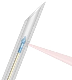 FIGURE 2. A 3D model of an imaging needle, showing the focusing optics fabricated by splicing and cleaving sections of optical fiber to shape the light beam. It uses total internal reflection to redirect the light through a small hole near the needle tip. FIGURE 2. A 3D model of an imaging needle, showing the focusing optics fabricated by splicing and cleaving sections of optical fiber to shape the light beam. It uses total internal reflection to redirect the light through a small hole near the needle tip.