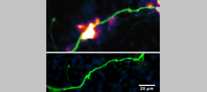 A schematic of DopaFilm shows spatially resolved hotspots of activity (top) and DopaFilm&rsquo;s fluorescent nanosensors glow brighter when exposed to dopamine (bottom).