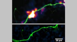 A schematic of DopaFilm shows spatially resolved hotspots of activity (top) and DopaFilm&rsquo;s fluorescent nanosensors glow brighter when exposed to dopamine (bottom).
