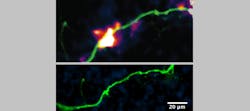A schematic of DopaFilm shows spatially resolved hotspots of activity (top) and DopaFilm’s fluorescent nanosensors glow brighter when exposed to dopamine (bottom). A schematic of DopaFilm shows spatially resolved hotspots of activity (top) and DopaFilm’s fluorescent nanosensors glow brighter when exposed to dopamine (bottom).