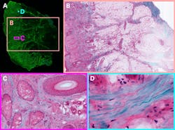 FIGURE 3. Hyperspectral images of tissue from the Giacomelli group: (a) a full centimeter-scale two-photon image of a tissue sample, and (b-d) a false-color image imitating histological stains, using signals from fluorescent stains (soma: pink; nucleus: purple) and SHG (collagen SHG: blue). (b) shows a wide region of the sample with many diverse features; (c) a region showing diverse tissue types, including a blood vessel; and (d) a collagen-rich region. Images were collected using TOPTICA&rsquo;s FemtoFiber Ultra 920 laser for two-photon excitation.