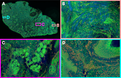FIGURE 2. Hyperspectral images of tissue from the Giacomelli group: (a) a full centimeter-scale two-photon image of a tissue sample, false-color RGB, using signals from fluorescent stains (protein: green; DNA: red) and SHG (collagen SHG: blue); (b) a collagen-rich region; (c) a protein-rich region; and (d) a DNA-rich region, showing many cell nuclei adjacent to a blood vessel. Images were collected using TOPTICA&rsquo;s FemtoFiber Ultra 920 laser for two-photon excitation.