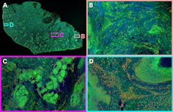 FIGURE 2. Hyperspectral images of tissue from the Giacomelli group: (a) a full centimeter-scale two-photon image of a tissue sample, false-color RGB, using signals from fluorescent stains (protein: green; DNA: red) and SHG (collagen SHG: blue); (b) a collagen-rich region; (c) a protein-rich region; and (d) a DNA-rich region, showing many cell nuclei adjacent to a blood vessel. Images were collected using TOPTICA’s FemtoFiber Ultra 920 laser for two-photon excitation. FIGURE 2. Hyperspectral images of tissue from the Giacomelli group: (a) a full centimeter-scale two-photon image of a tissue sample, false-color RGB, using signals from fluorescent stains (protein: green; DNA: red) and SHG (collagen SHG: blue); (b) a collagen-rich region; (c) a protein-rich region; and (d) a DNA-rich region, showing many cell nuclei adjacent to a blood vessel. Images were collected using TOPTICA’s FemtoFiber Ultra 920 laser for two-photon excitation.