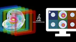 FIGURE 1. The new microscope re-distributes light from a volume such that many depths are imaged simultaneously next to each other, allowing a fast camera to record the entire volume in a single shot.