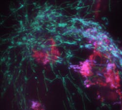 FIGURE 3. Unlike the traditional depiction of mitochondria (bean-shaped), living mitochondria look much rather like microscopic worms. This snapshot, taken with the new microscope, shows them crawling around all over a cell. To show the third dimension, the depth is coded from purple over green to red. The whole volume was taken in a single camera exposure. FIGURE 3. Unlike the traditional depiction of mitochondria (bean-shaped), living mitochondria look much rather like microscopic worms. This snapshot, taken with the new microscope, shows them crawling around all over a cell. To show the third dimension, the depth is coded from purple over green to red. The whole volume was taken in a single camera exposure.