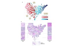 FIGURE 2. The algorithm sorted out the breast cancer patients based on their tumor biopsy images. Each point represents a biopsy image. The algorithm placed tumors it predicted to express PD-L1 on the right side, and tumors it predicted to not express on the left. Per the algorithm, the patients on the left side should not receive the immunotherapy treatment and the ones on the right should. Interestingly, the algorithm placed cases at the bottom when their classification was inconclusive, probably because their biopsy images were deficient. The pathologists' diagnosis is noted for some of the cases, revealing inconsistencies in determining the PD-L1 expression. FIGURE 2. The algorithm sorted out the breast cancer patients based on their tumor biopsy images. Each point represents a biopsy image. The algorithm placed tumors it predicted to express PD-L1 on the right side, and tumors it predicted to not express on the left. Per the algorithm, the patients on the left side should not receive the immunotherapy treatment and the ones on the right should. Interestingly, the algorithm placed cases at the bottom when their classification was inconclusive, probably because their biopsy images were deficient. The pathologists' diagnosis is noted for some of the cases, revealing inconsistencies in determining the PD-L1 expression.