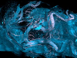 Aortic regions of a human heart whose vascular plaques have been analyzed by DISCO-MS, a 3D spatial-omics technology that uses robotics to acquire proteomics data from cells identified early in diseases. Aortic regions of a human heart whose vascular plaques have been analyzed by DISCO-MS, a 3D spatial-omics technology that uses robotics to acquire proteomics data from cells identified early in diseases.