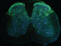 Neurons in the spinal cord (blue), including those that send signals about pain (green), captured using one of the new wearable microscopes. Neurons in the spinal cord (blue), including those that send signals about pain (green), captured using one of the new wearable microscopes.