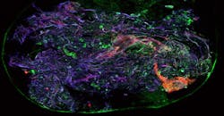 Multi Photon Microscopy Lung Tissue Vrije Uni Amsterdam 1540x800 Multi Photon Microscopy Lung Tissue Vrije Uni Amsterdam 1540x800