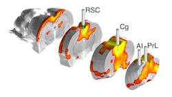 FIGURE 2. A default mode network, as examined by fMRI and fiber photometry.