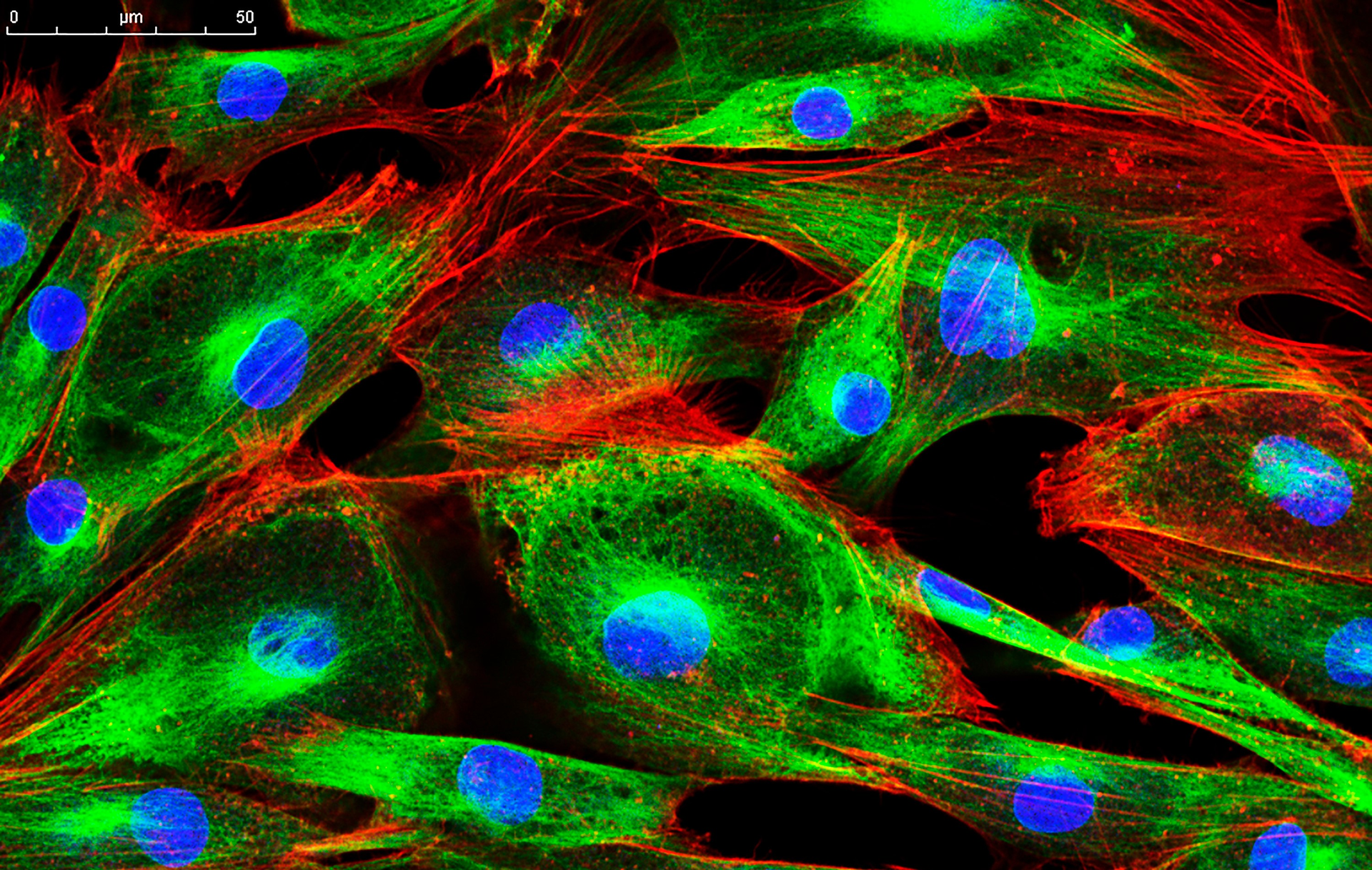 FIGURE 1. Multiphoton, or nonlinear, microscopy, uses ultrafast laser sources for capturing high-resolution three-dimensional (3D) images with reduced photobleaching and phototoxicity compared to traditional confocal microscopy techniques. However, pulse spreading can make multiphoton microscopy images like this one become blurry.