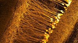 Detailed image of neurons in a mouse brain, as captured using the Schmidt objectives.