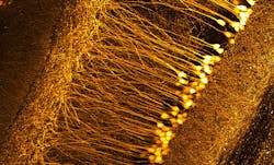Detailed image of neurons in a mouse brain, as captured using the Schmidt objectives.