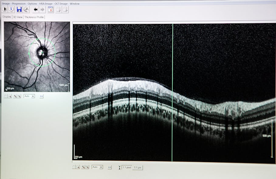 FIGURE 4. OCT image of the optic nerve.