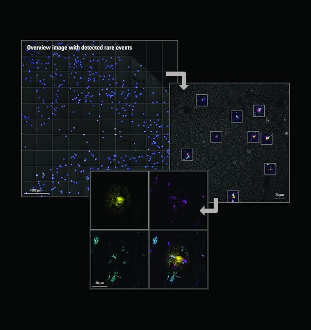 FIGURE 2. Study of proteins involved in neurodegenerative diseases. Visualization of microglial activity (TSPO) and engulfment (Homer1 and CD68) around amyloid-plaque (MX04) in 50-&mu;m-thick human brain sections (Alzheimer&rsquo;s disease donors). Duration of automated image acquisition: ~5 hours. Objects of interest: 3D high-resolution image stacks of 516 detected rare events.
